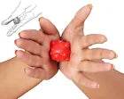 Acupressure Plastic Thumb Pad Jimmys, Sujok Balls, Sujok Acupressure Rings - StellerGear